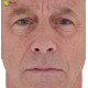 Male 40 Head Scan Cleaned